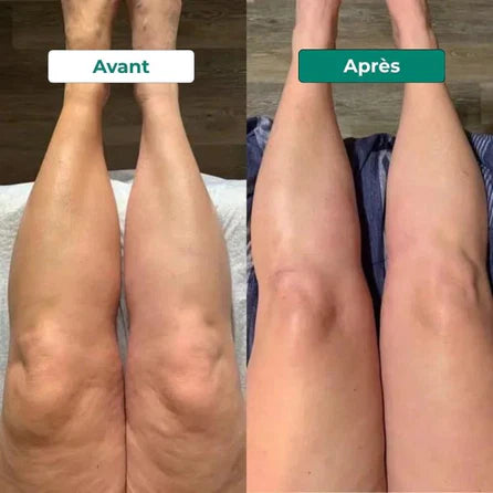 Avant après 2