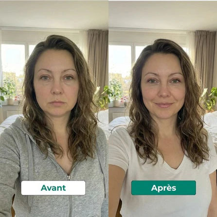 Avant après 5